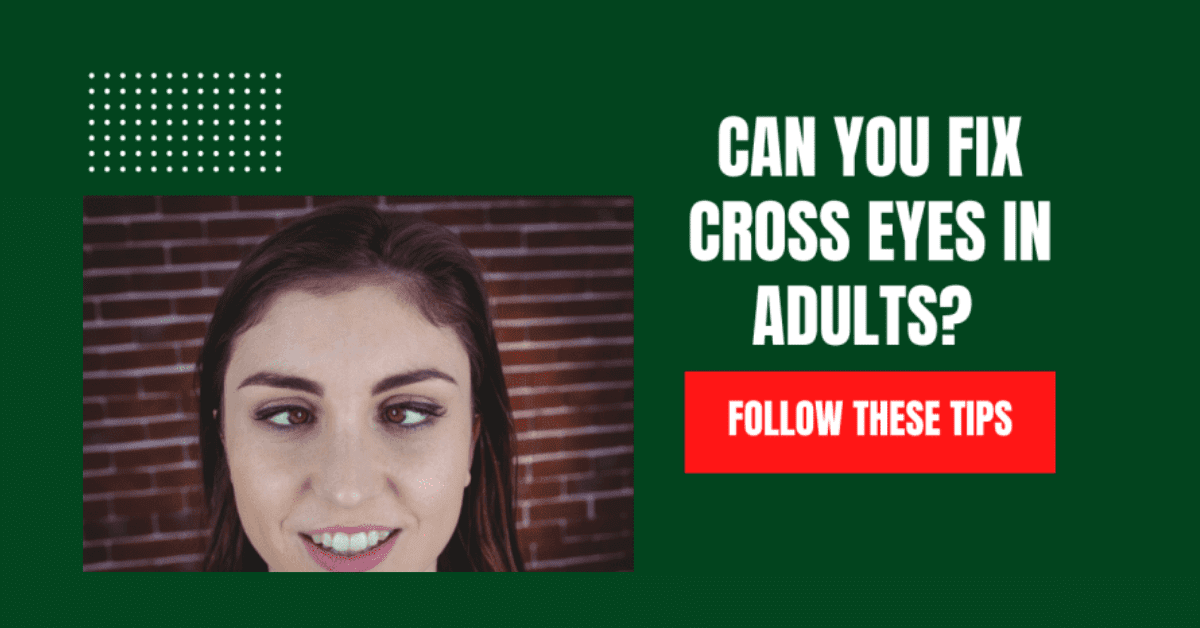 Can You Fix Cross Eyes In Adults? Follow These Tips 2022