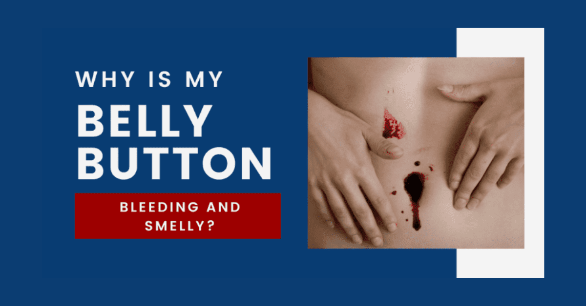 why-is-my-belly-button-bleeding-and-smelly-2022