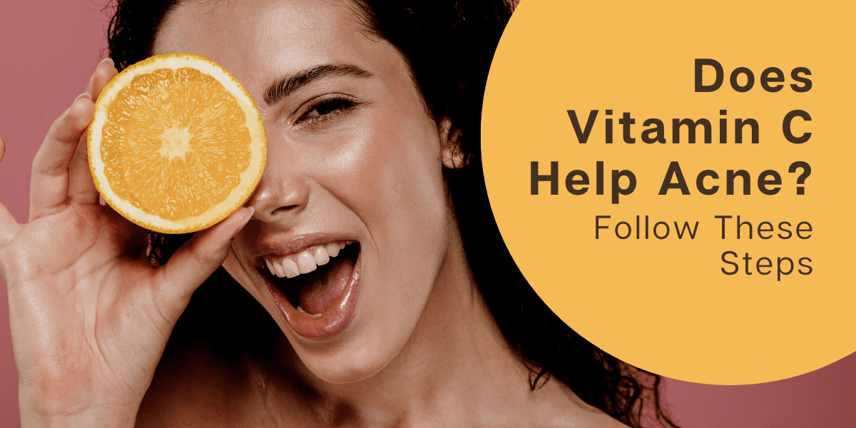 does-vitamin-c-help-acne-follow-these-steps-2022