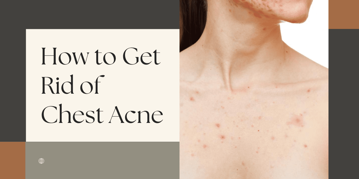 How To Get Rid Of Chest Acne 2022